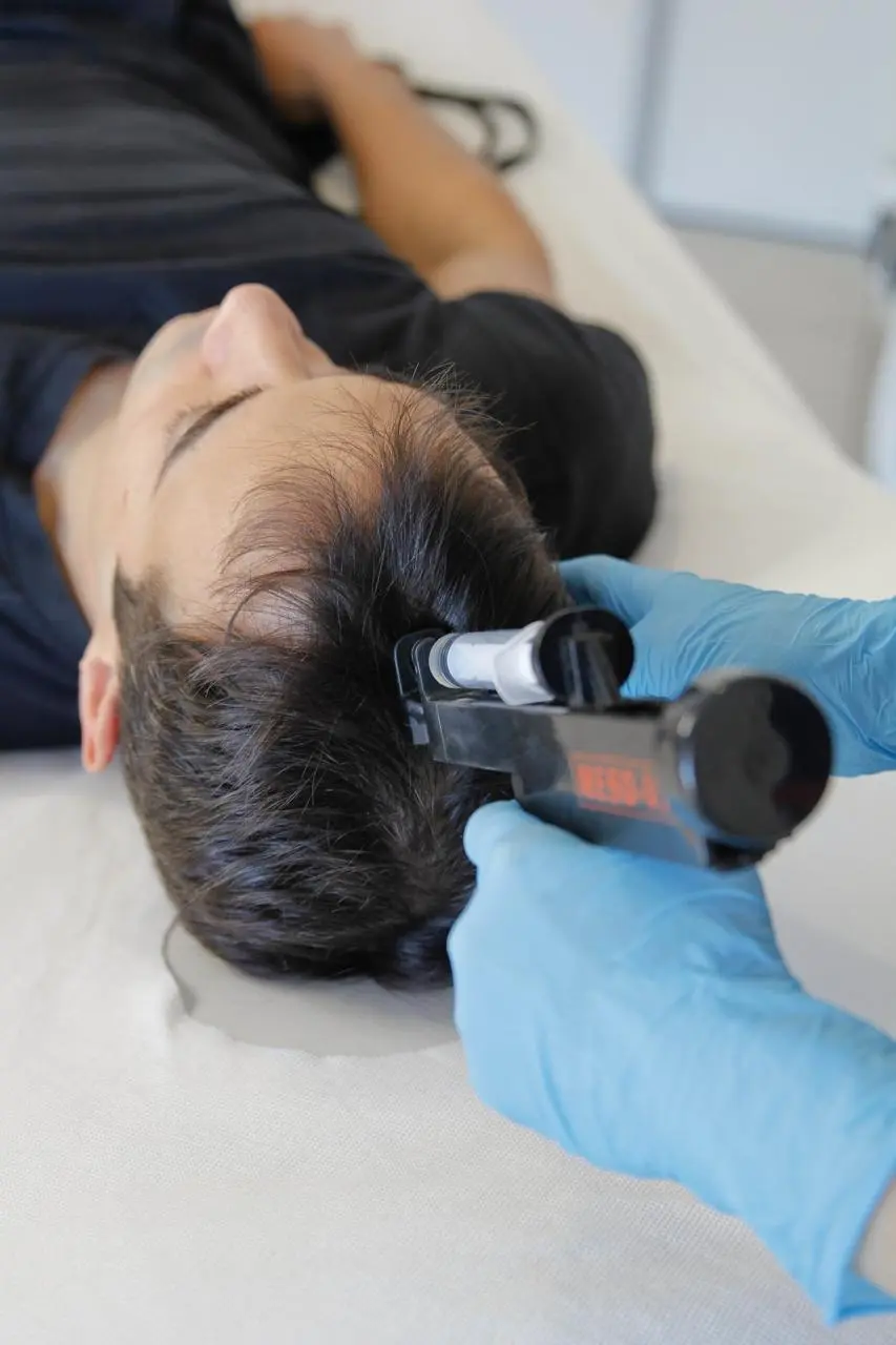 Mesoterapia Capilar